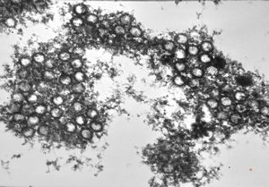 M,11d. | herpes virus, adrenal M,11d. | herpes virus, adrenal
